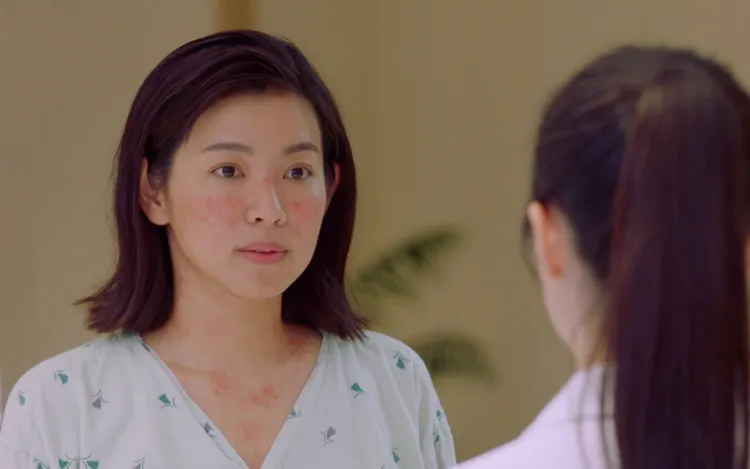 米可白客串演出紅斑性狼瘡病患，拍攝前得畫特殊傷妝。東森提供