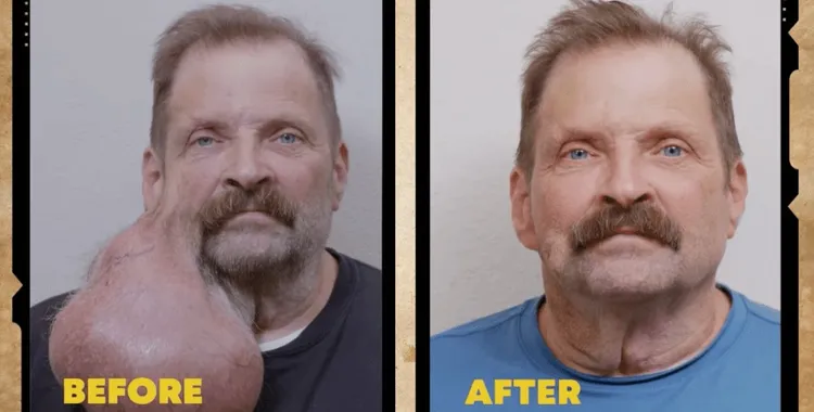 提姆手術後已恢復本來面貌。翻攝自太陽報