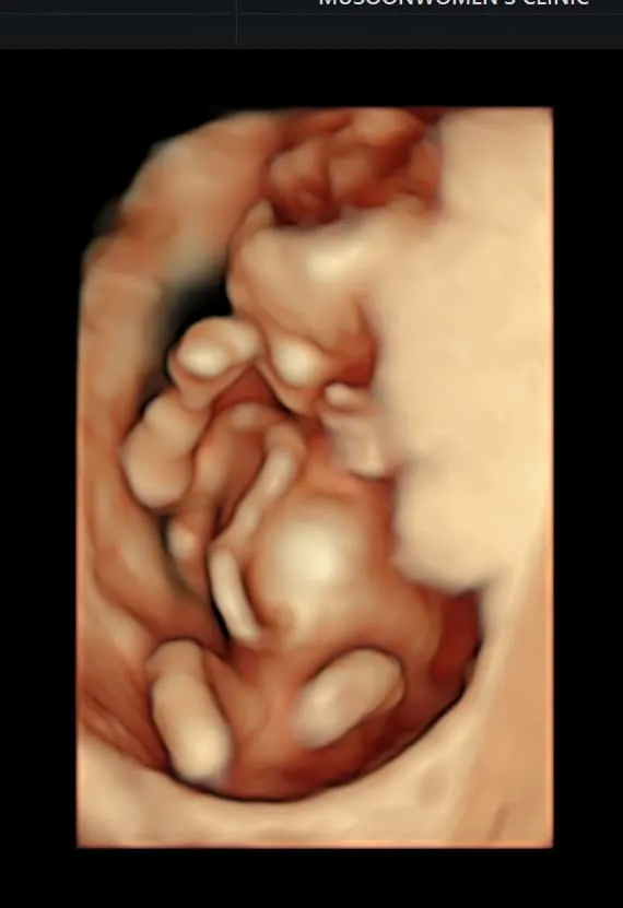 劉香慈開心表示，寶寶心跳聲好迷人。翻攝劉香慈臉書