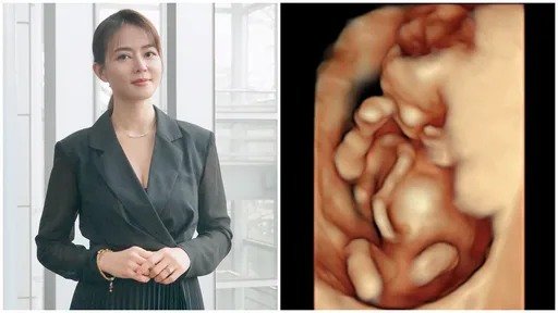 劉香慈高齡懷第3胎 不敢驗「唐氏症」!曝心中有堅定答案