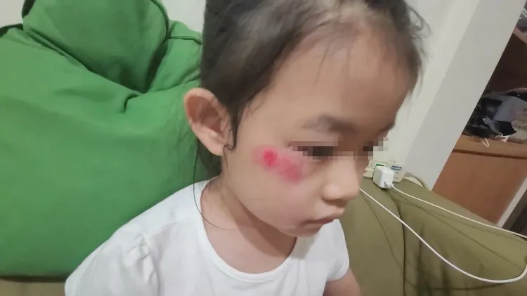 馬力歐心疼女兒受傷。翻攝馬力歐臉書