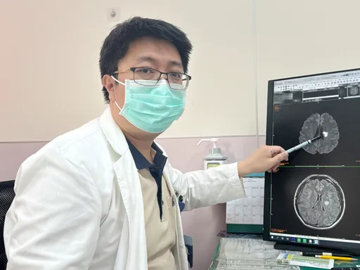 未遵醫囑過量服用精神藥物 40歲壯男血壓飆破200突中風