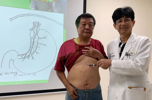 像牛一吃东西就反刍!他被「老毛病」困扰50年 微创三合一手术根治