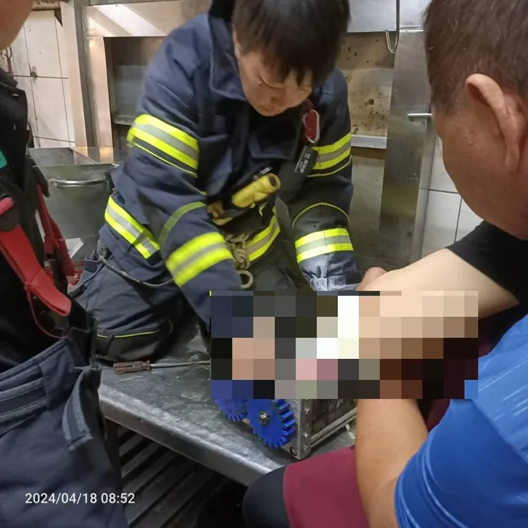 26歲肉攤女員工，右手掌被絞肉機捲入。民眾提供