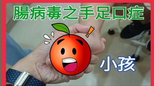 病毒真的來了!手腳全水泡「酒精殺不死」 6大前兆快就醫