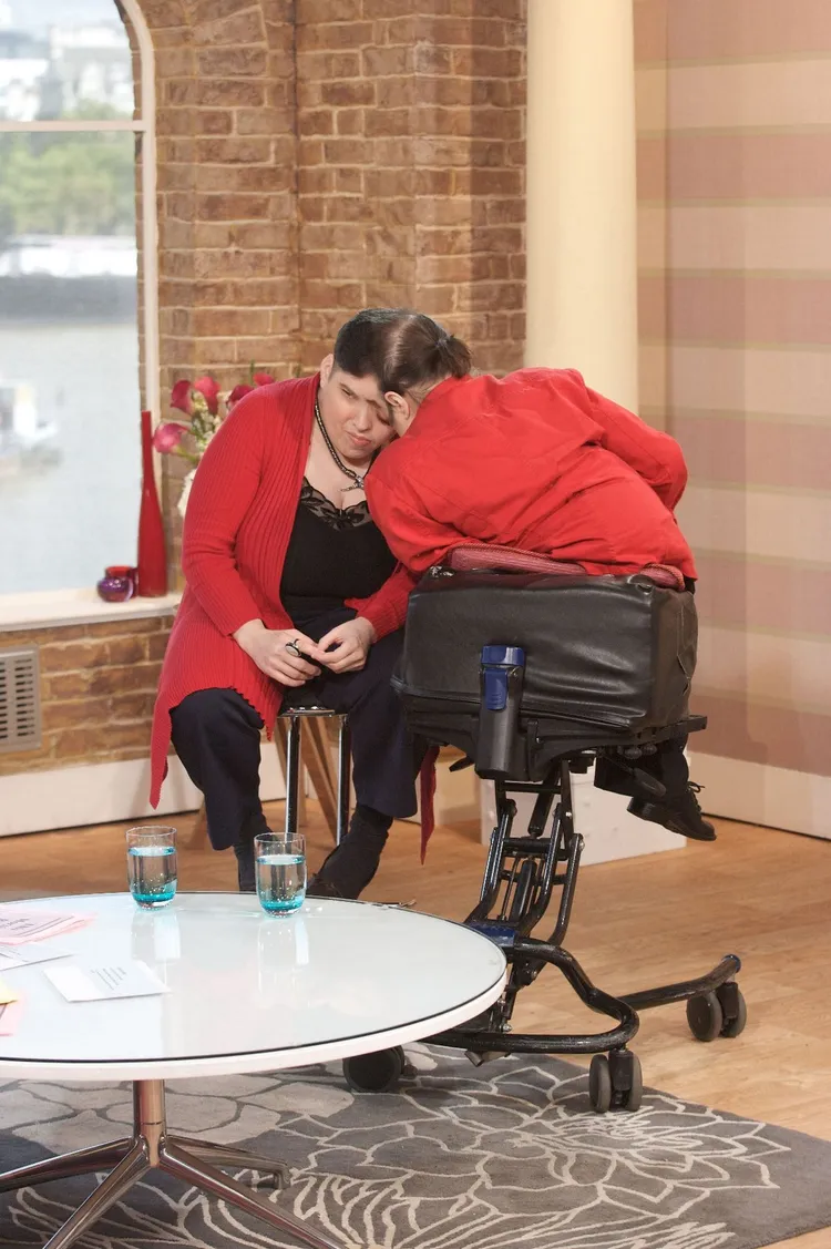 夏佩爾姊弟共用30%大腦。翻攝自每日星報