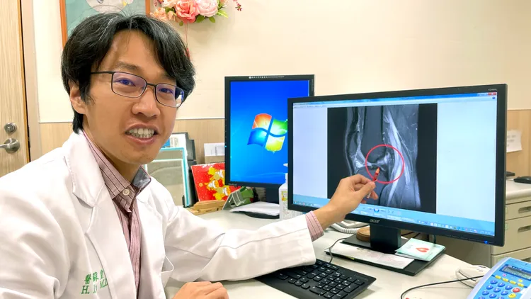 亞大附醫骨科部蘇皇儒醫師建議，藉由「十字韌帶重建合併固定手術」可增加膝蓋穩定度，重新找回運動力。院方提供