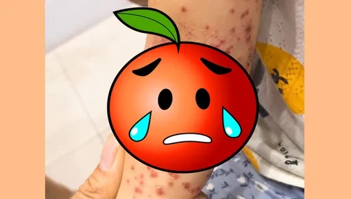 幼兒園動不動就停課 原來「這隻病毒」害的!醫師曝罹病慘況