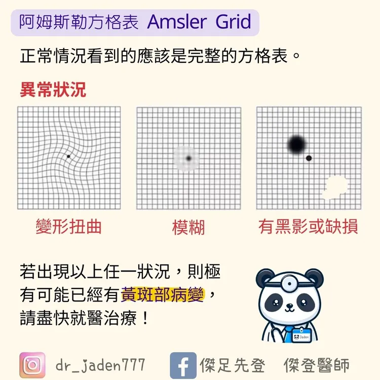 若出現線條扭曲、模糊、有黑影或缺損狀況，則極有可能已經有黃斑部病變 。圖取自傑登醫師臉書