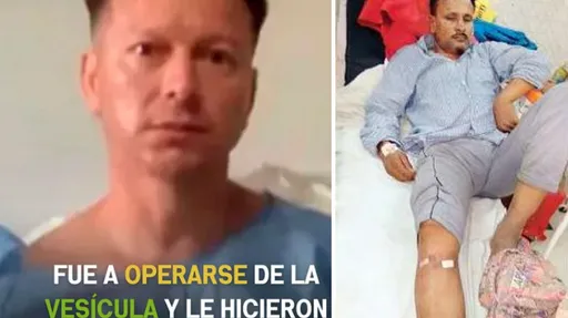 民生醫院烏龍案|有人「被結紮」有人開錯腿 外國開錯刀原因百百種