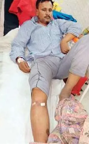 印度男子帝亞吉頭部受傷，右腿卻被打鋼釘。翻攝The Times of India