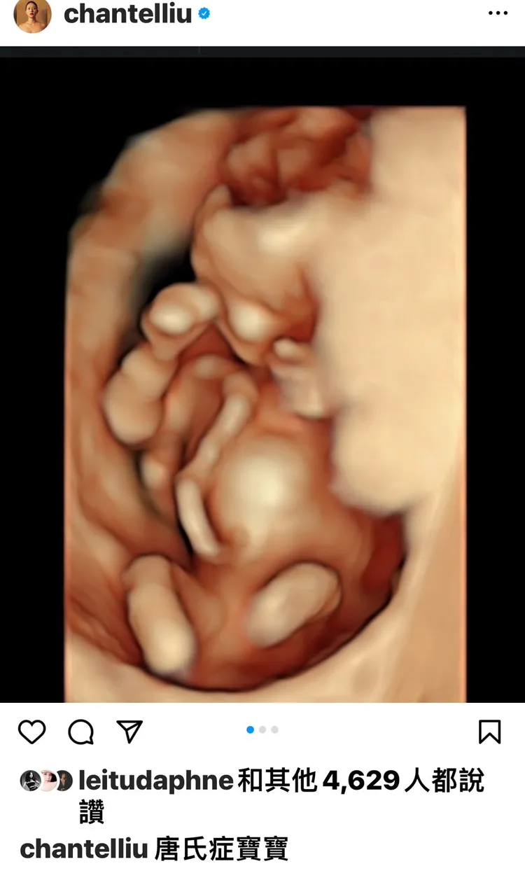 劉香慈標題「唐氏症寶寶」。翻攝劉香慈臉書
