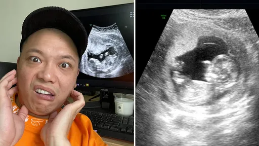 《瘋神無雙》阿虎要當爸爸了!向寶寶道歉「並非富二代」