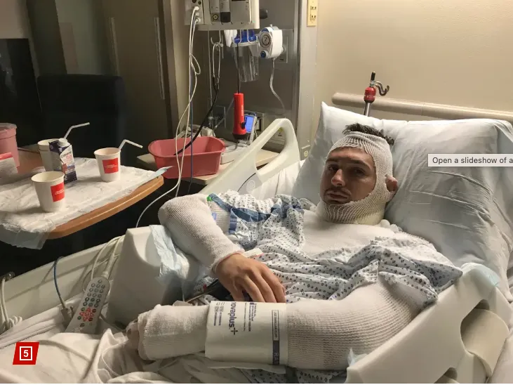 受害者為23歲男子，目前正住院中，身體的3分之1被燒傷。翻攝　New York Post