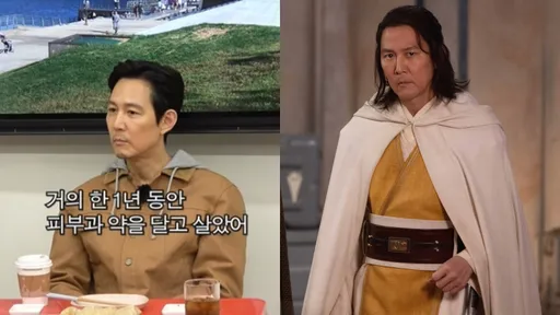 李政宰加盟《星戰》壓力山大!國外拍攝冒痘水腫「服用1年皮膚科藥」