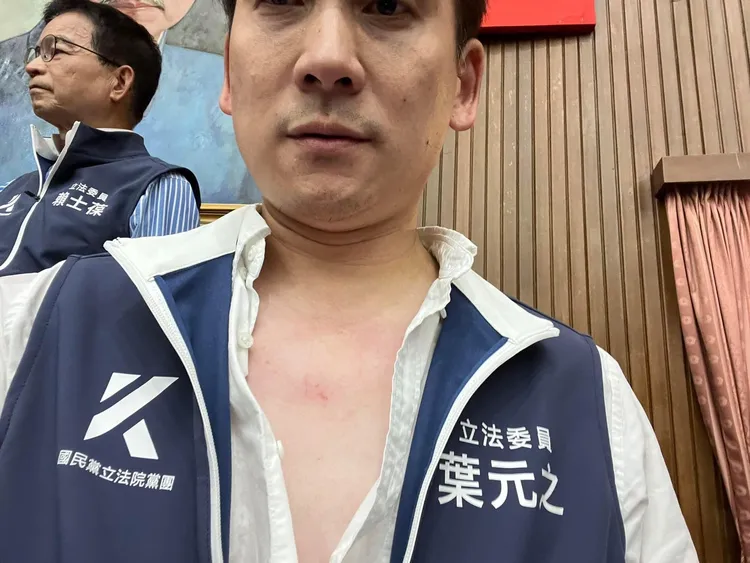 葉元之秀出他的白皙胸膛，只見上方出現數道指甲抓痕。葉元之提供