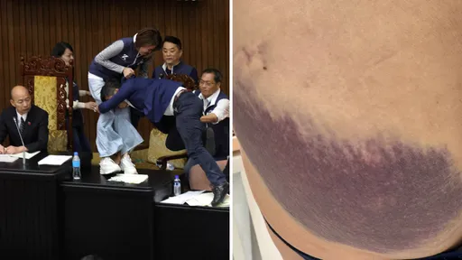 「我沒有辦法制止鍾佳濱」　陳菁徽痛哭秀「臀部大片瘀青照」　