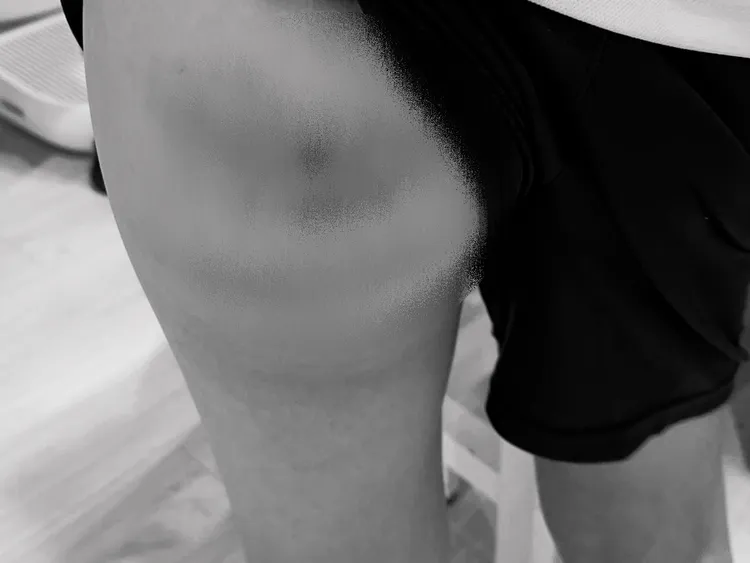 家長在網上控訴，兒子遭到羽球教練體罰。翻攝自臉書