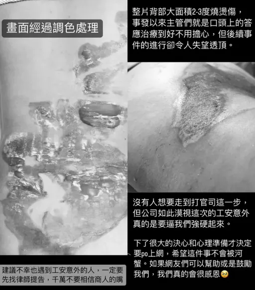 員工遭滾燙湯鍋砸身!業者刁難1年「狂砍賠償金」 家屬淚揭內幕求助