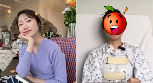 美女空姐跌倒往後重摔撞頭 公開「左邊頭蓋骨被削」最新近況