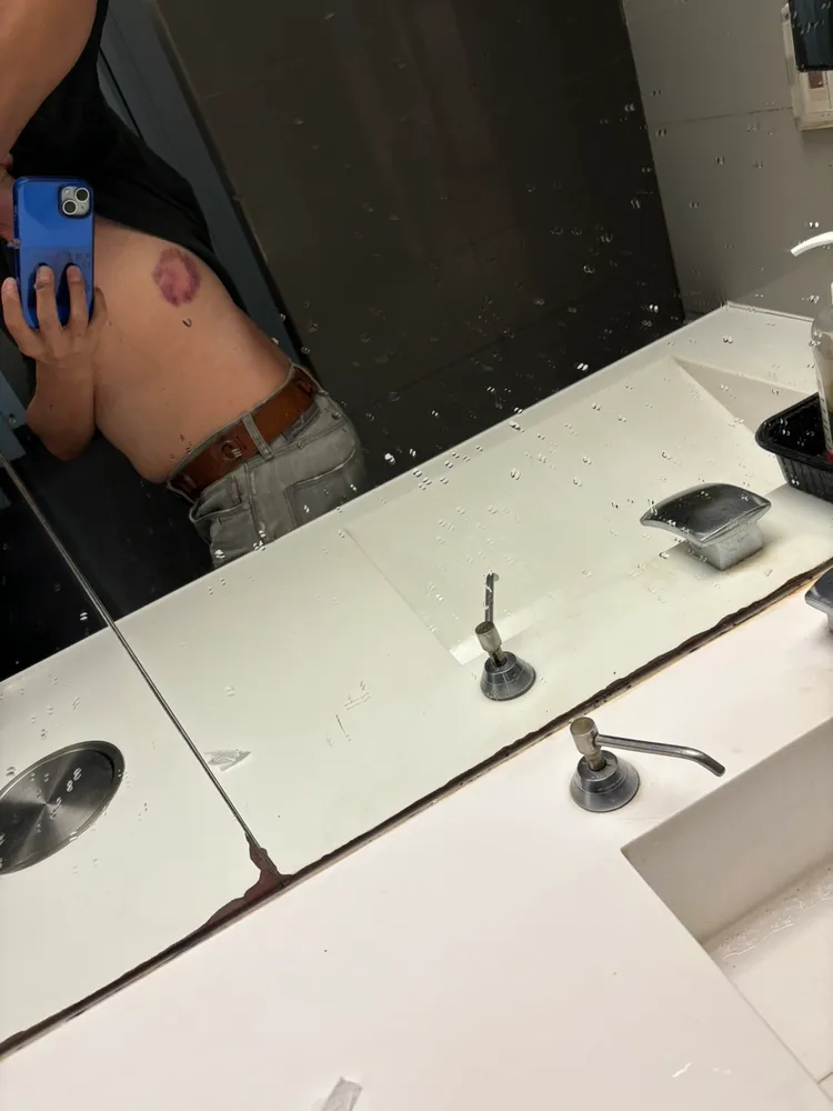 蘇炳憲檢查傷勢。民視提供