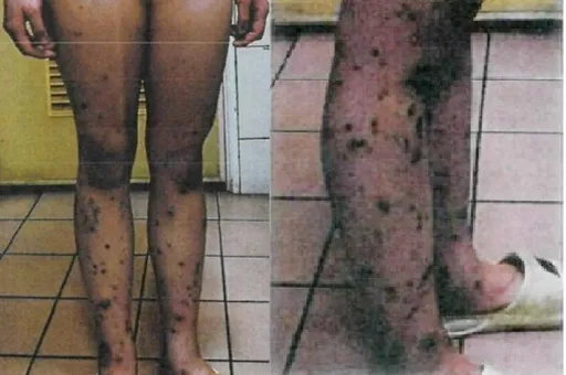 壞透了!輪流性侵19歲女還大腿針刺「婊子」凌虐 「霸道總裁」夫妻5人重判