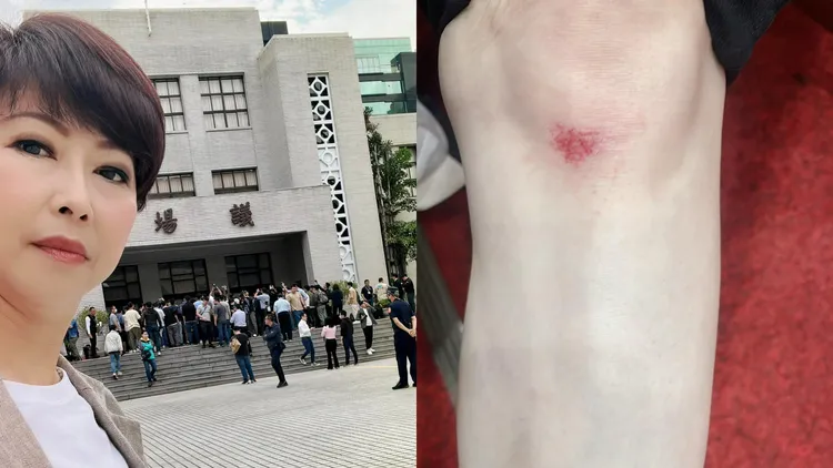 陳亭妃曝光膝蓋傷勢。翻攝陳亭妃臉書