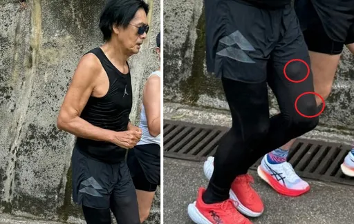 周潤發左大腿驚冒2顆球狀凸起物!網憂腫瘤催就診