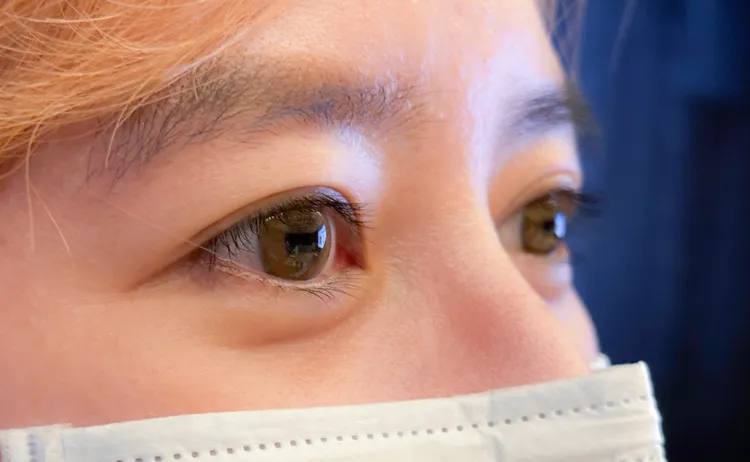 醫師呼籲大眾要保護好靈魂之窗。院方提供