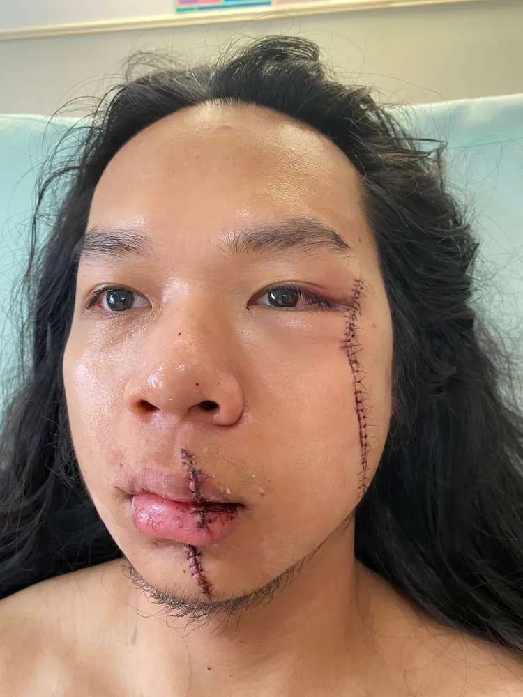 長髮哥臉上2道疤痕令網友看了十分不捨。民眾提供