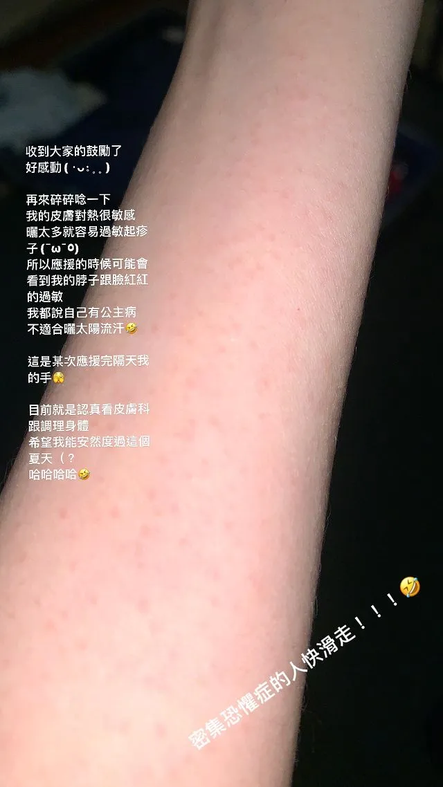 一粒自嘲有公主病，不適合曬太陽流汗。翻攝一粒 IG
