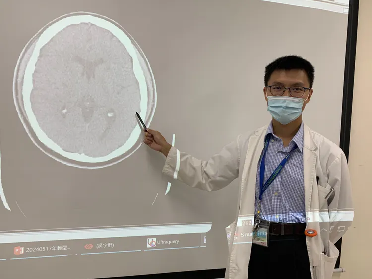 神經內科醫師吳宇軒說，患者到院斷層掃描確定沒有腦出血，為梗塞型腦中風，可用靜脈血栓溶解劑治療。台中醫院提供