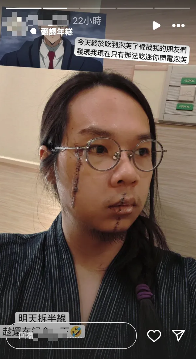 中捷「長髮哥」預計今（28）日將拆除臉部傷口縫線。翻攝當事人IG