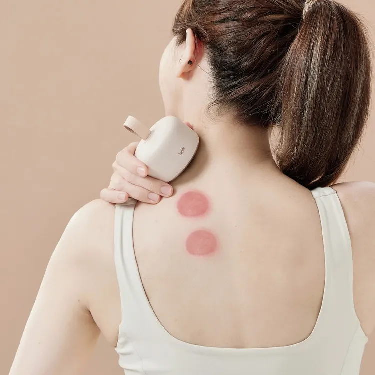 lisscode｜Smio.C 遠紅外線溫感拔罐儀。業者提供