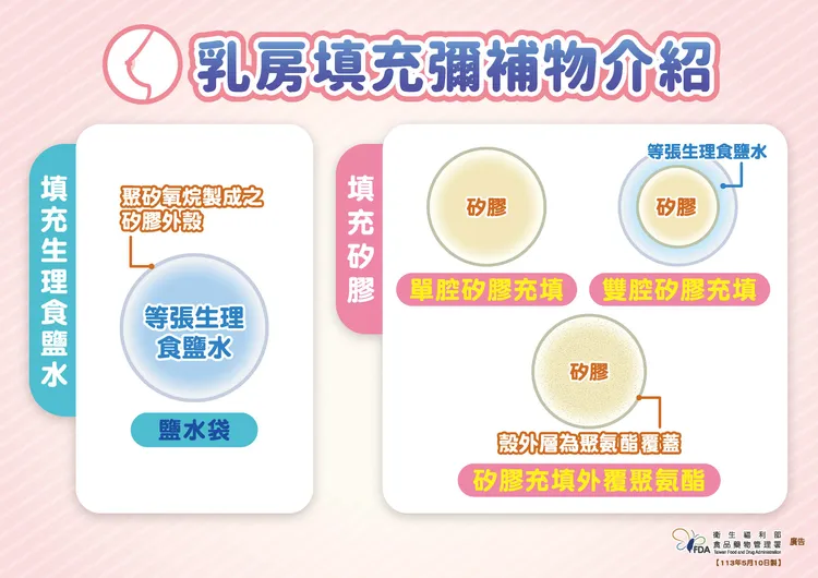 隆乳、乳房整型相關衛教說明。食藥署提供
