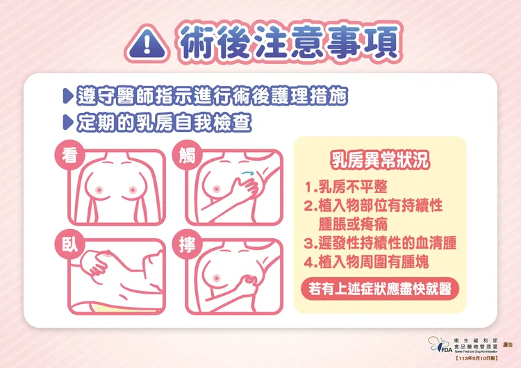 隆乳、乳房整型相關衛教說明。食藥署提供