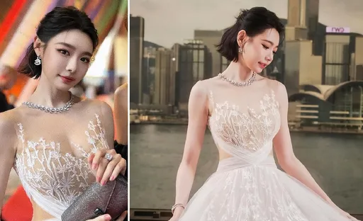 「真人版娜美」林明禎全面停工!生病2個月好不了 強忍各種疼痛