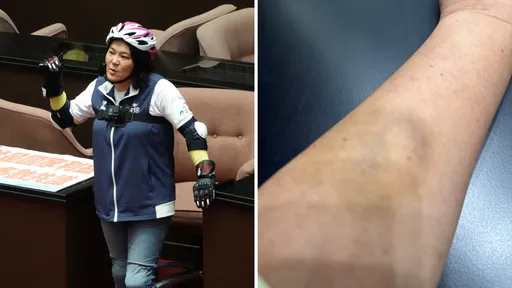 「金門坦克」陳玉珍帶「光榮安全帽」　曝遭林淑芬咬傷「敬重她是認真立委」 