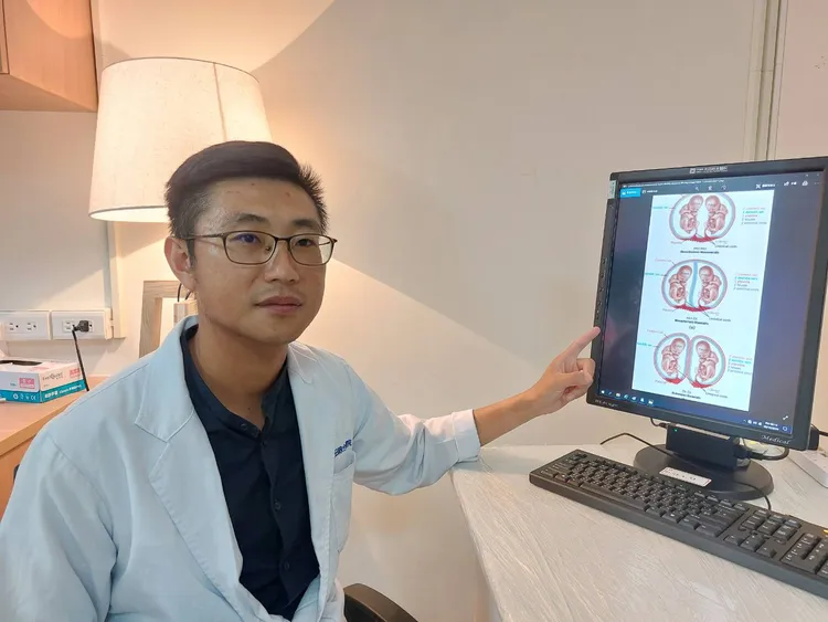 陳穎中醫師去年接獲雙胞胎共用胎盤的案例，幸好最後母子三人均安。光田醫院提供