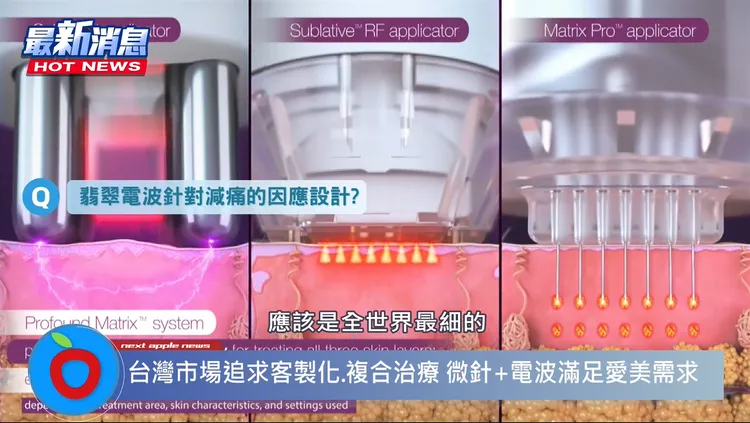 翡翠電波透過極細微針配合三段式加熱達到精準高效的治療效果，此外三款把手、一機三效，搶攻台灣醫美抗老市場商機！