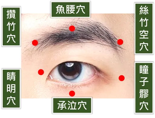 青光眼年轻化趋势 中医、西医合并治疗很有效