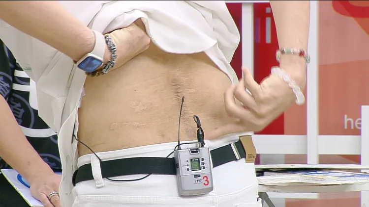 葉諾帆露出開刀的疤痕。和展影視提供