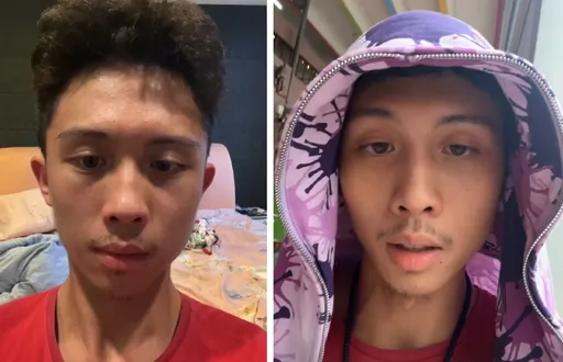 孫安佐直播曝過非人生活被綁在床上6天！嫌媽媽「噁心」但還是愛她　