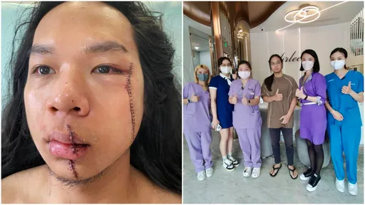 獨家|「中捷長髮哥」不後悔肉搏歹徒 醫美贊助今手術去除「蜈蚣疤」