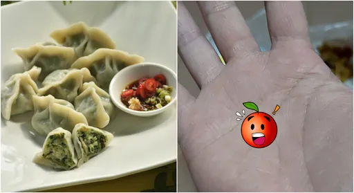 水餃咬到硬物以為是紅豆 一看竟是「動物性蛋白」差點吐出來