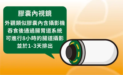 不用再害怕腸道檢查 膠囊內視鏡「一錠搞定」