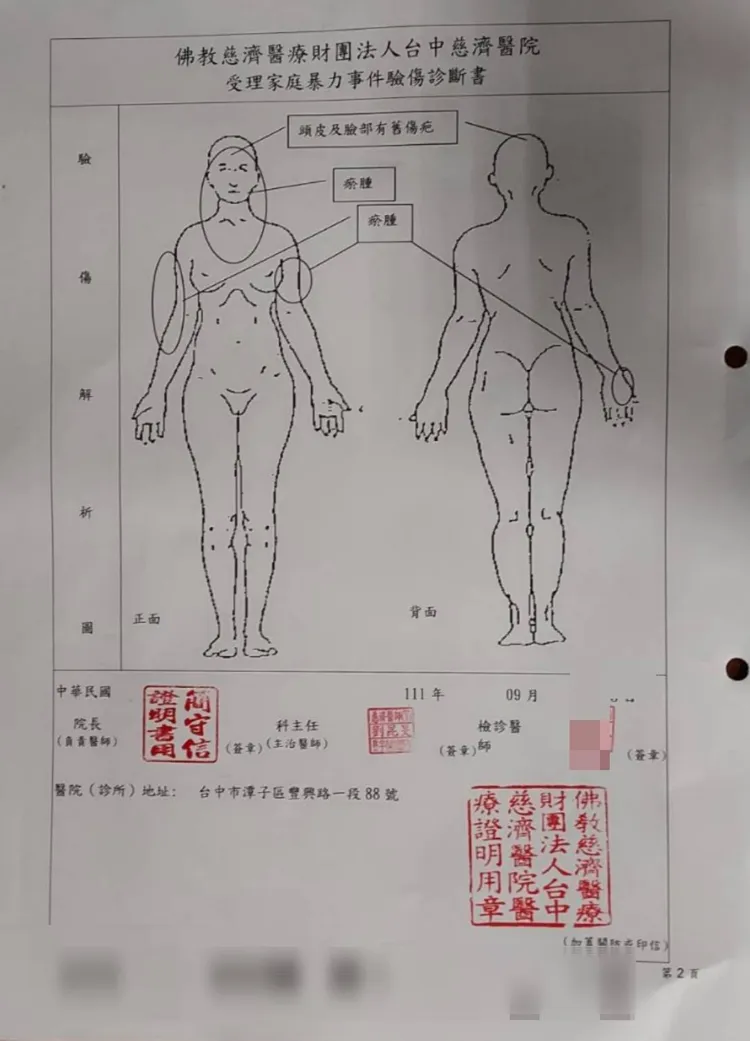 紀妻被打得渾身是傷。翻攝畫面