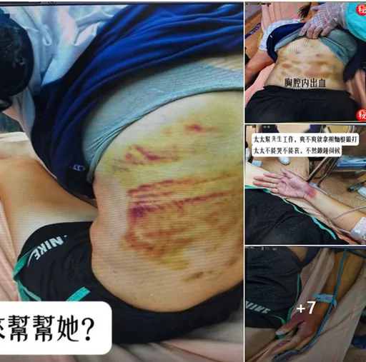 人妻被打到胸腔出血快瞎了 2子目睹嚇壞!她還求法官輕判家暴夫