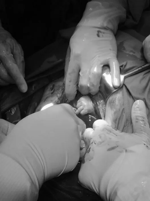 寶寶伸出求援的手，網友讚嘆：好感動的一刻。翻攝施景中臉書