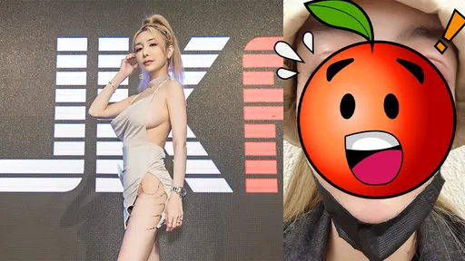 情色教主腫麼了?臉部腫到「睜不開眼」慘照曝光